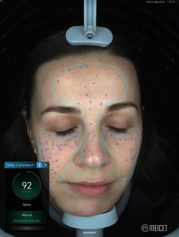 Snímka diagnostiky 2
