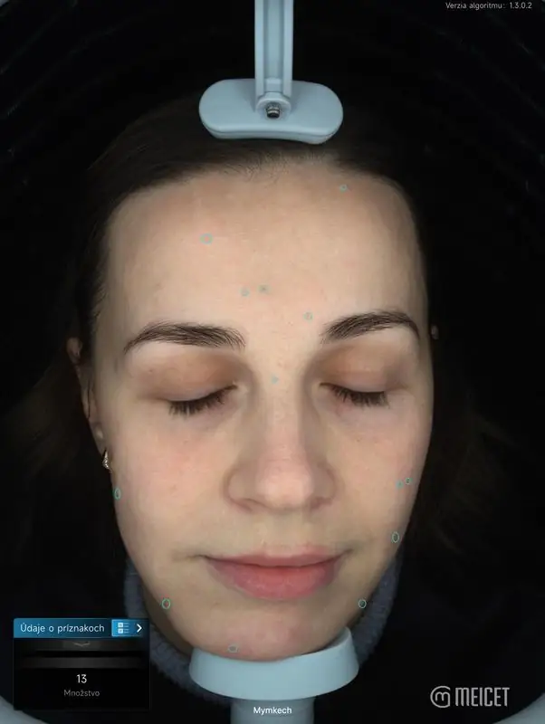 Snímka diagnostiky 6